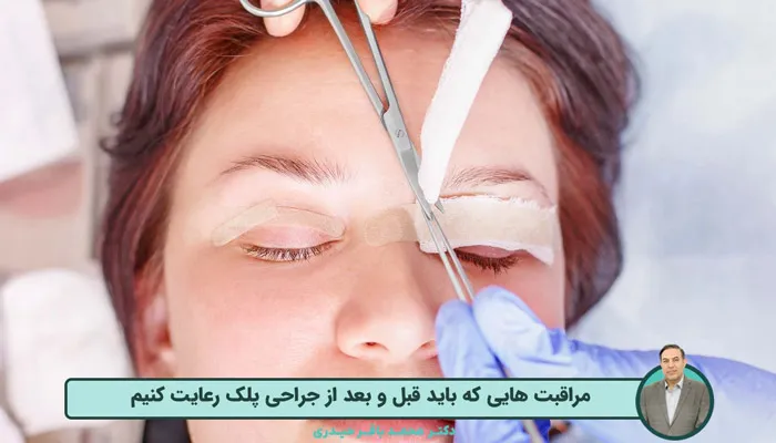 مراقبت های قبل و بعد ار جراحی پلک (بلفاروپلاستی)