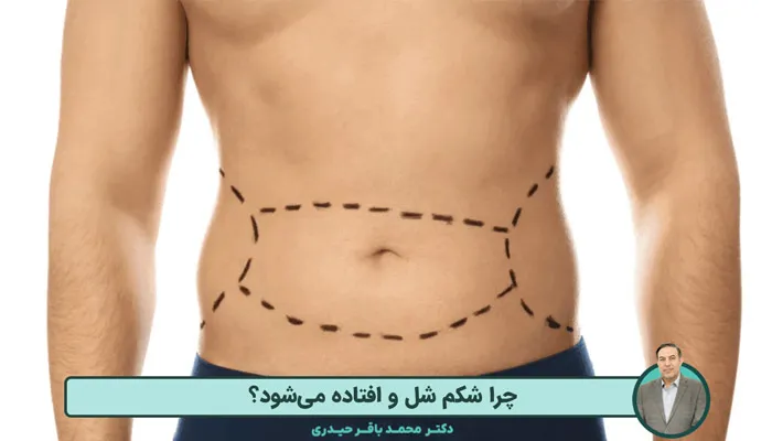 چرا شکم شل و افتاده میشود؟