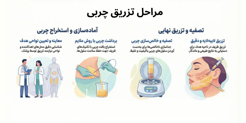 مراحل انجام تزریق چربی
