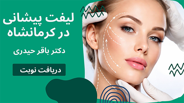 لیفت پیشانی در کرمانشاه.