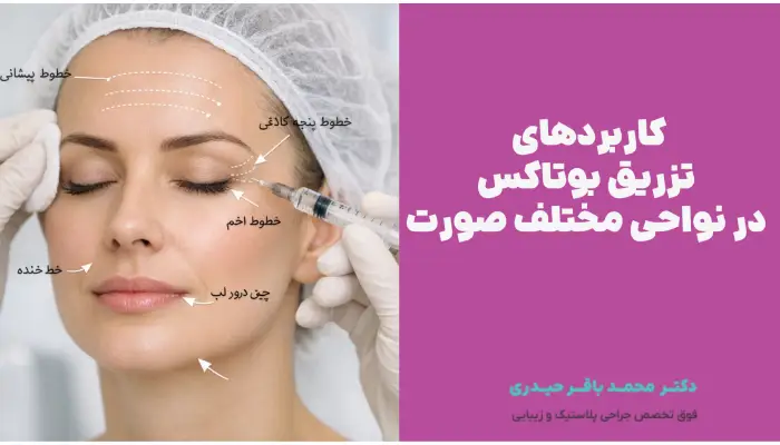 کاربردهای تزریق بوتاکس در نواحی مختلف صورت
