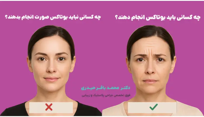 کاندیدای تزریق بوتاکس صورت