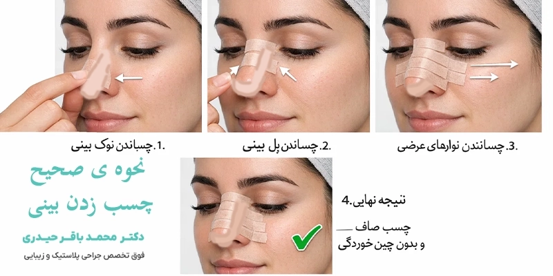 نحوه صحیح چسب زدن بینی بعد از جراحی